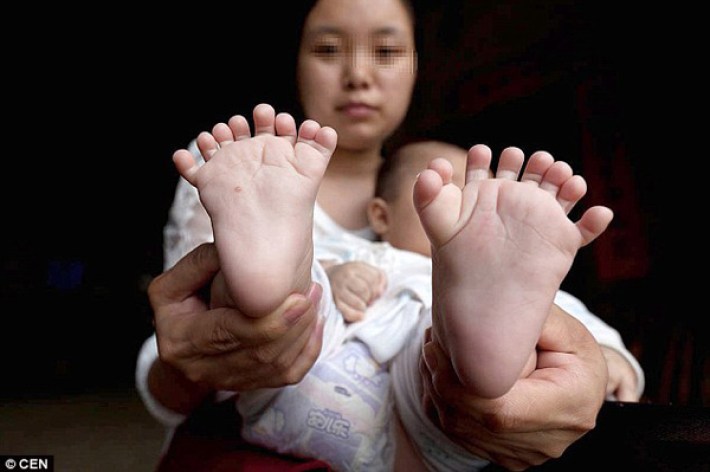 ps.Hong Kong Welcomes the Exceptional Birth of a Baby Born with 31 Fingers and Toes, Achieving a Guinness World Record (Video). - Newspaper World