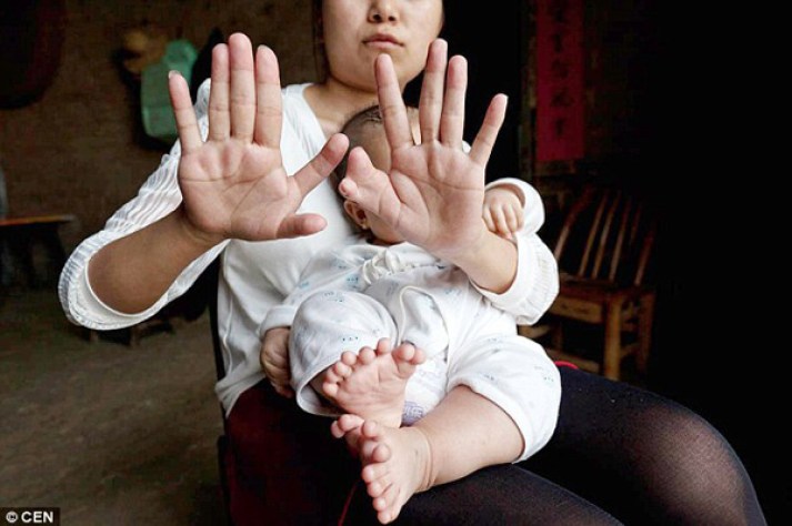 ps.Hong Kong Welcomes the Exceptional Birth of a Baby Born with 31 Fingers and Toes, Achieving a Guinness World Record (Video). - Newspaper World