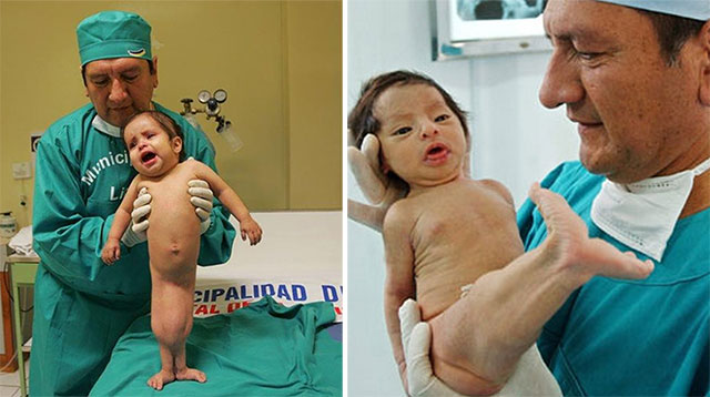 nhat.India Witnesses an Astonishing Birth: Baby Born with a Fish Tail Leaves Spectators Awestruck. - Hot News MamaMath